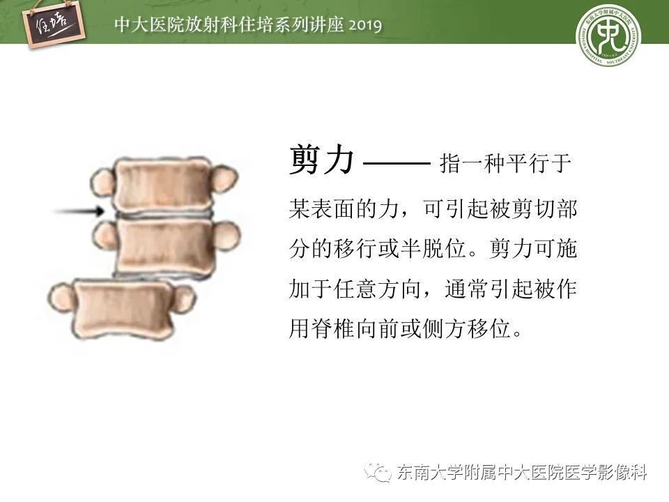 【PPT】脊柱创伤