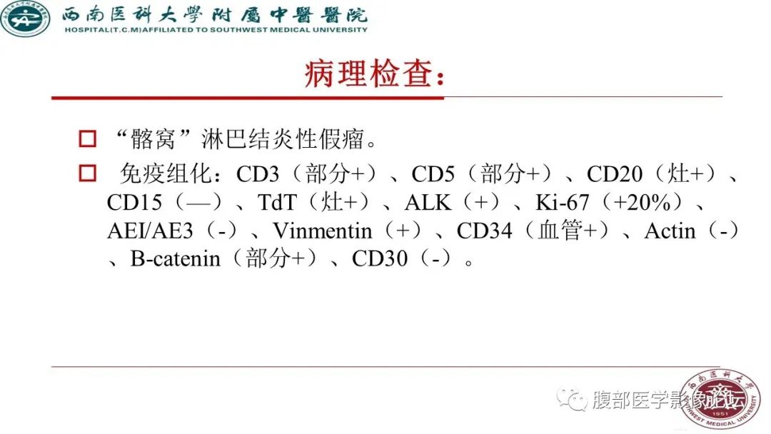 【病例】髂窝淋巴结炎性假瘤1例CT及MR影像诊断