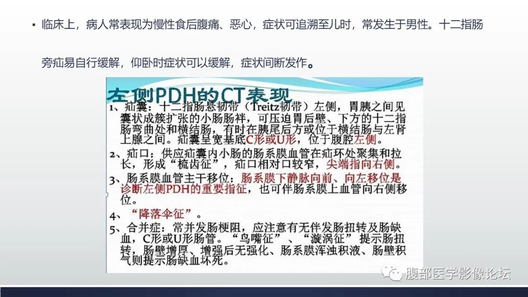 【病例】腹内疝1例CT影像诊断