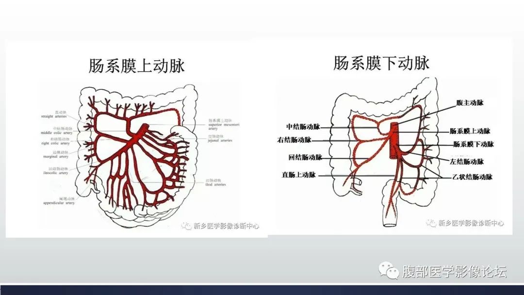 【病例】腹内疝1例CT影像诊断