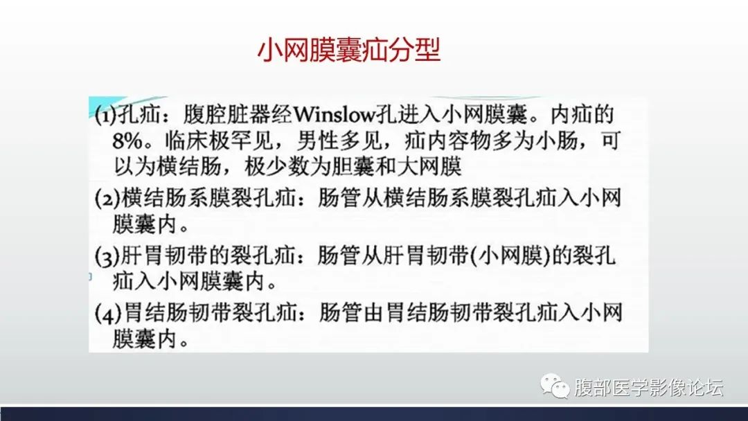 【病例】腹内疝1例CT影像诊断