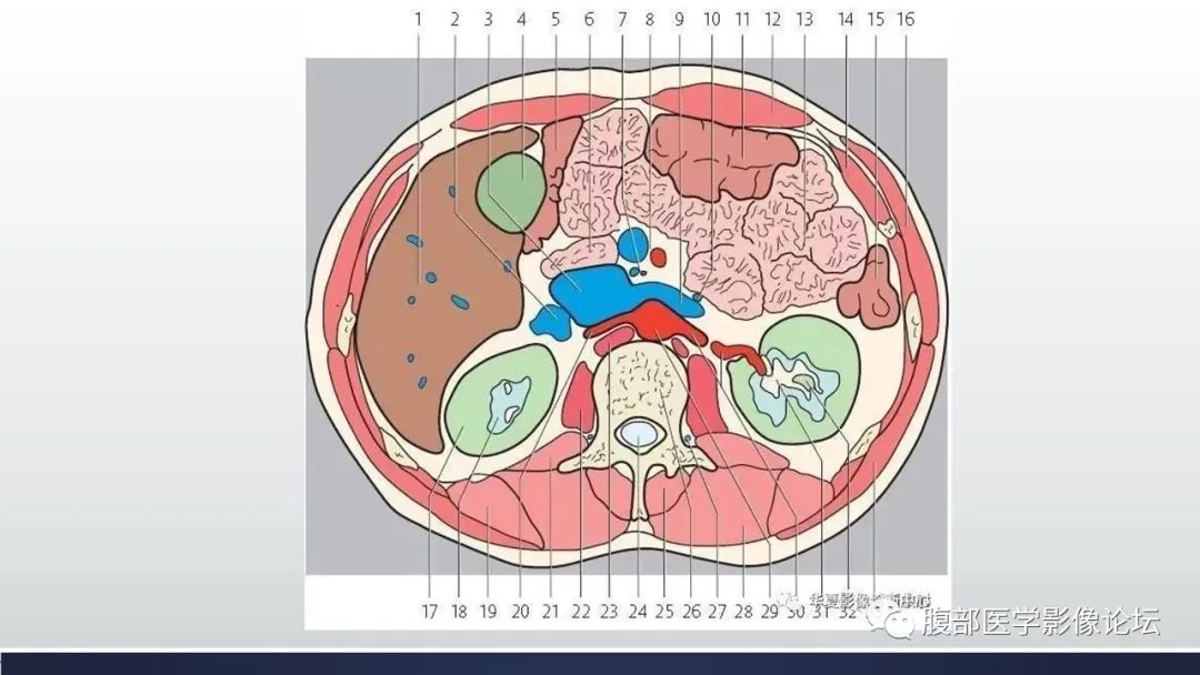 【病例】腹内疝1例CT影像诊断