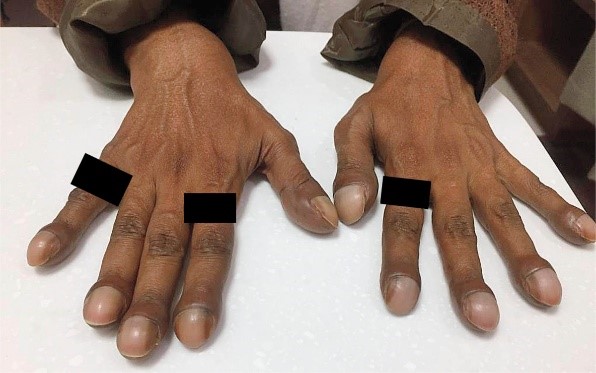 1583832039379500.jpg