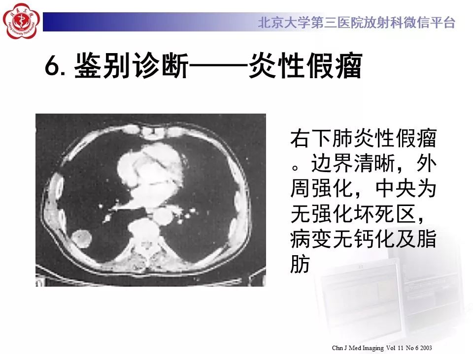 【PPT】肺错构瘤的CT影像