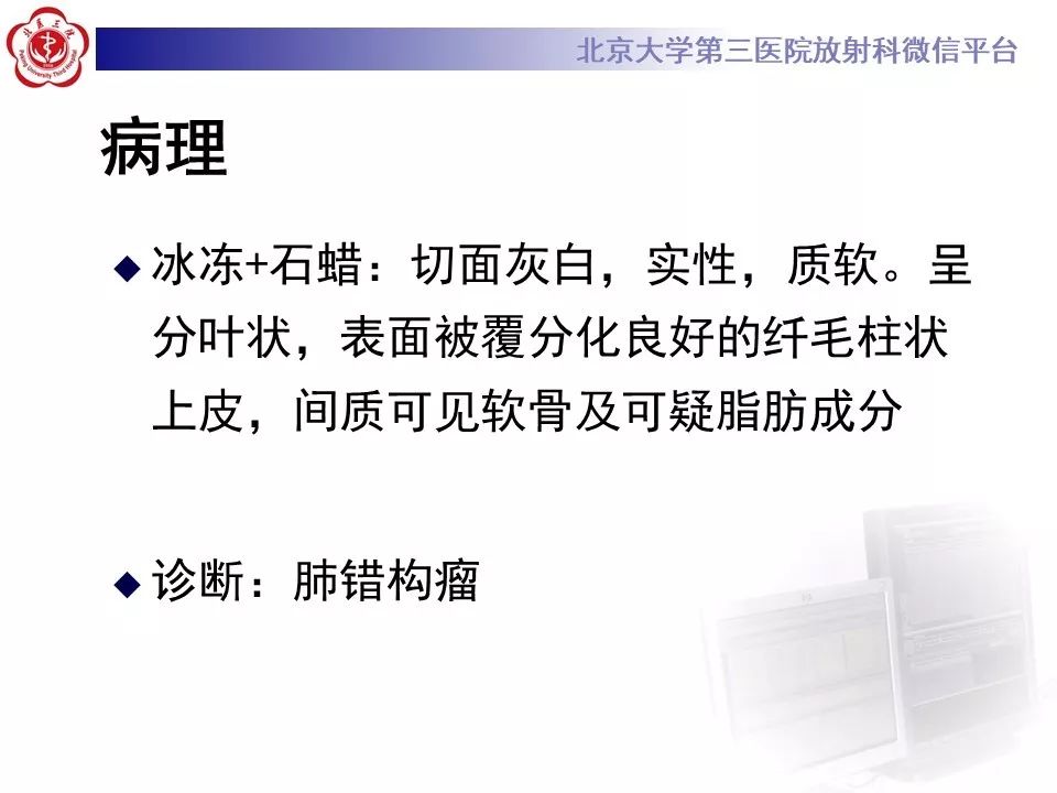 【PPT】肺错构瘤的CT影像