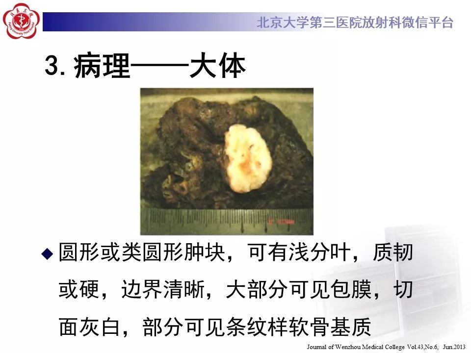 【PPT】肺错构瘤的CT影像
