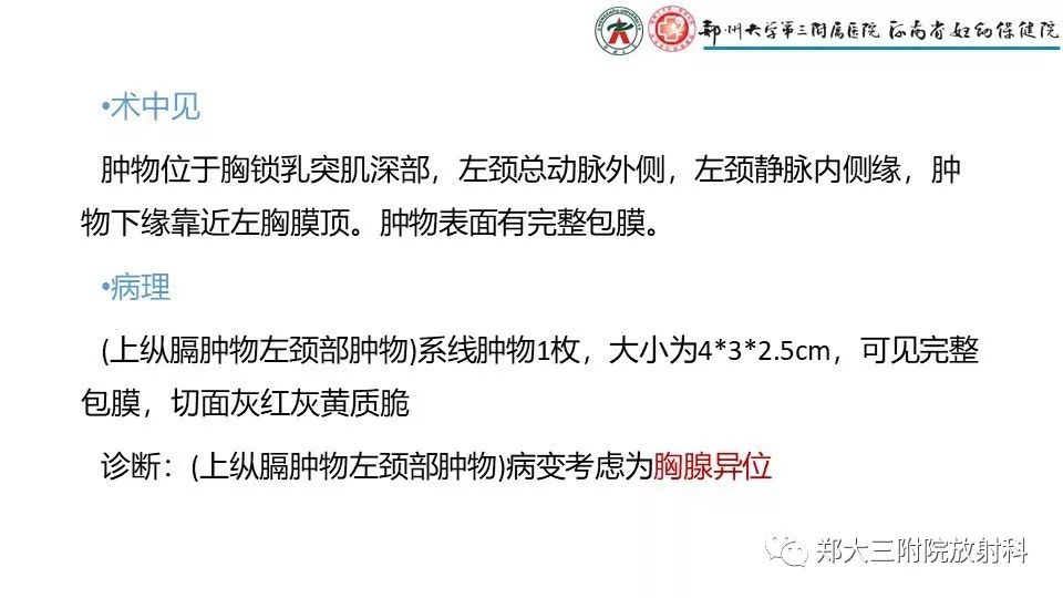 【病例】异位胸腺1例CT影像