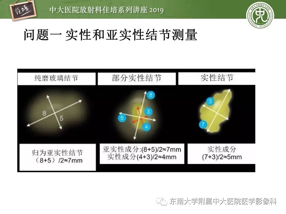 【PPT】肺结节的影像诊断及临床管理