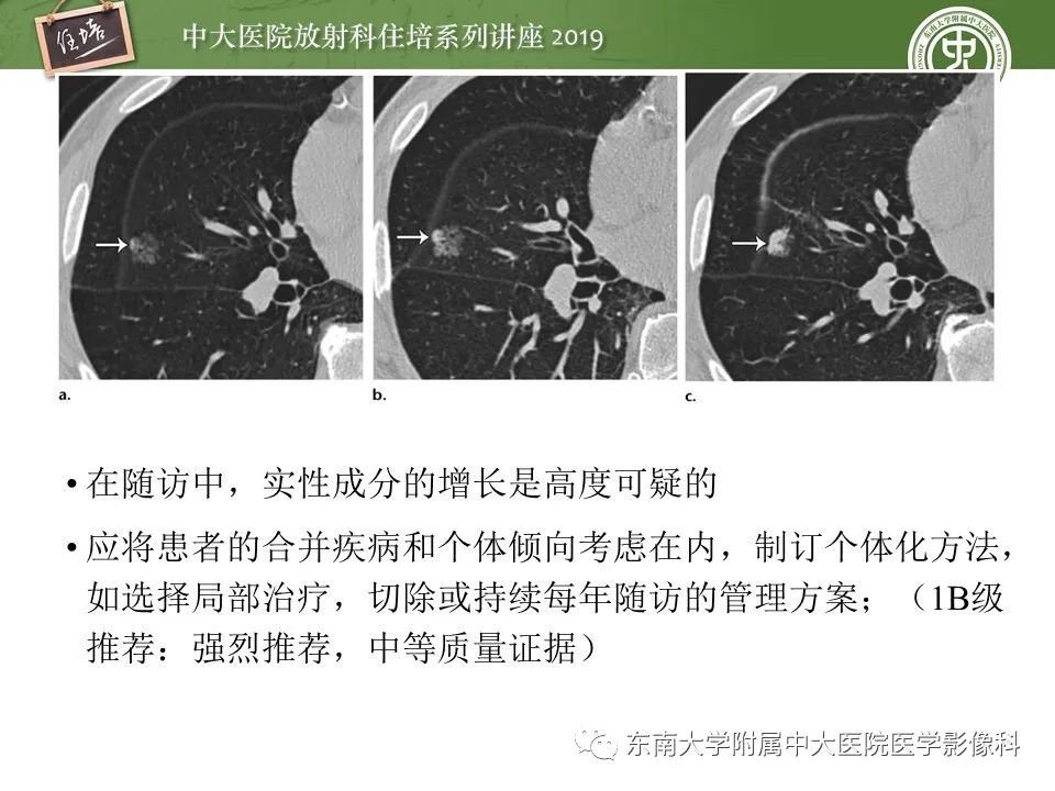 【PPT】肺结节的影像诊断及临床管理