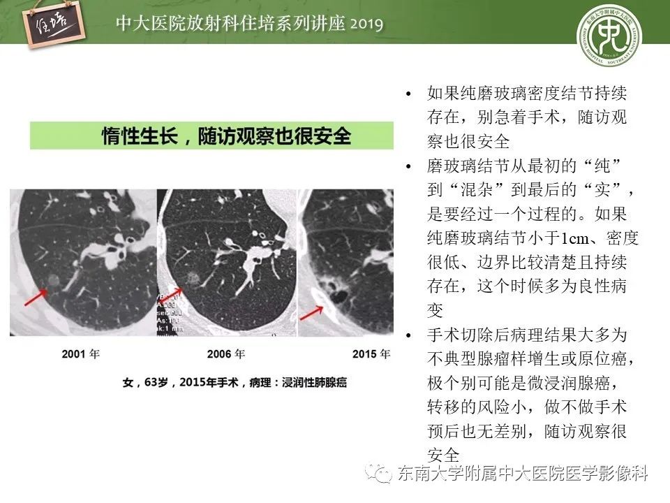 【PPT】肺结节的影像诊断及临床管理