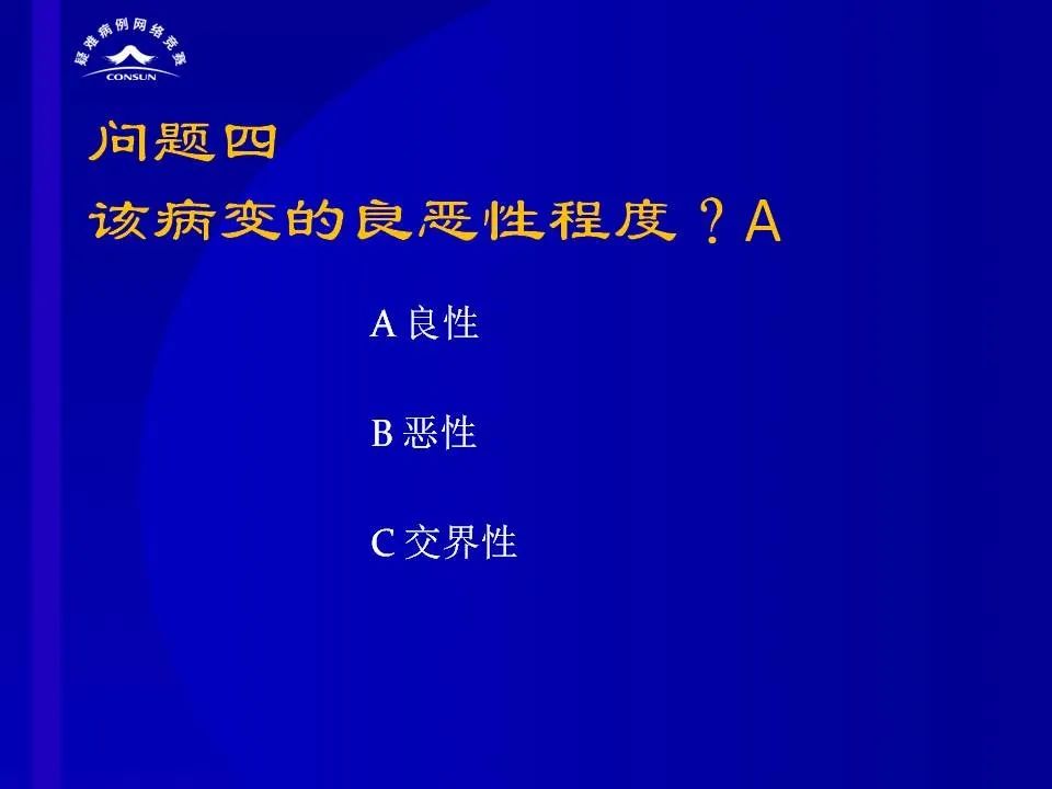 【病例】脊髓节细胞胶质瘤1例MR影像解析 【病例】脊髓节细胞胶质瘤1例MR影像解析
