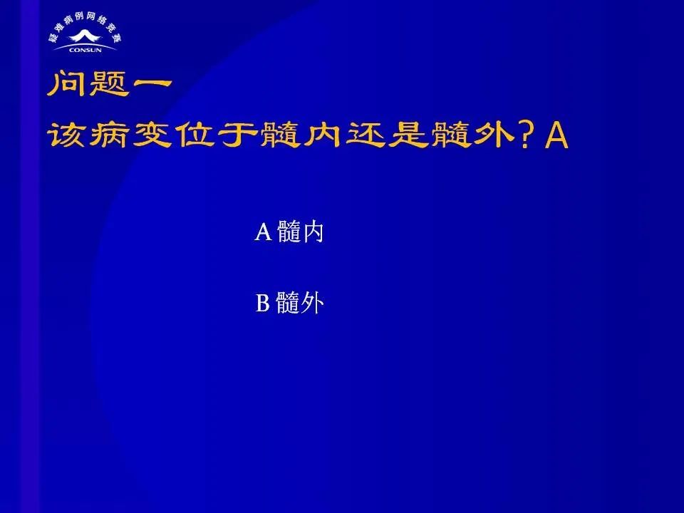 【病例】脊髓节细胞胶质瘤1例MR影像解析 【病例】脊髓节细胞胶质瘤1例MR影像解析