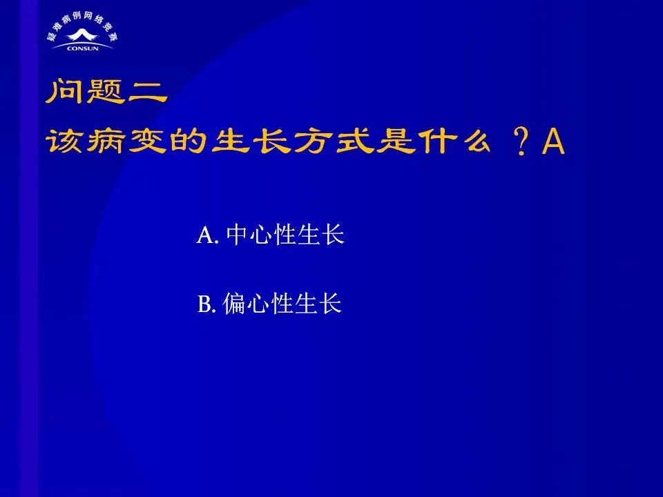【病例】脊髓节细胞胶质瘤1例MR影像解析 【病例】脊髓节细胞胶质瘤1例MR影像解析