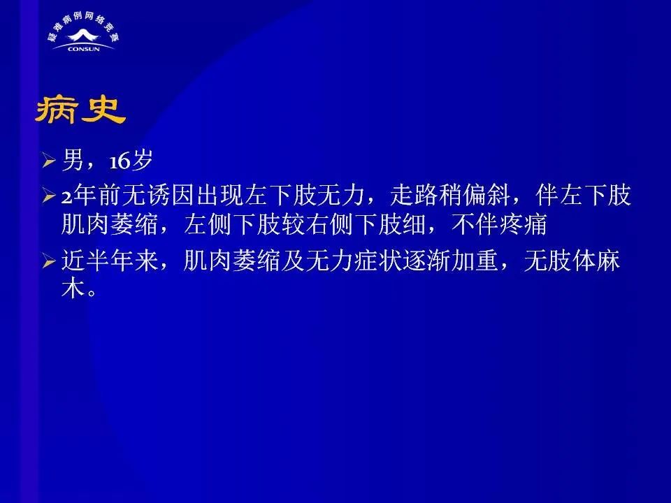 【病例】脊髓节细胞胶质瘤1例MR影像解析 【病例】脊髓节细胞胶质瘤1例MR影像解析