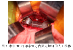 图3.png