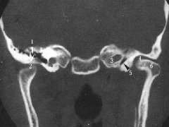 口腔颌面部CT诊断