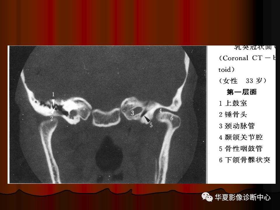 【PPT】口腔颌面部CT诊断 【PPT】口腔颌面部CT诊断