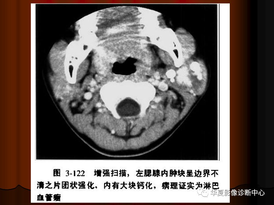【PPT】口腔颌面部CT诊断 【PPT】口腔颌面部CT诊断