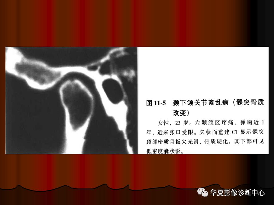 【PPT】口腔颌面部CT诊断 【PPT】口腔颌面部CT诊断