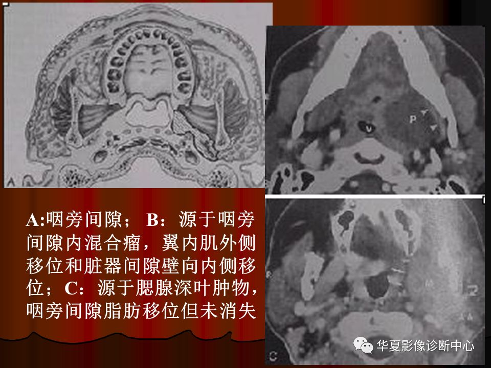 【PPT】口腔颌面部CT诊断 【PPT】口腔颌面部CT诊断