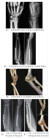 图.png