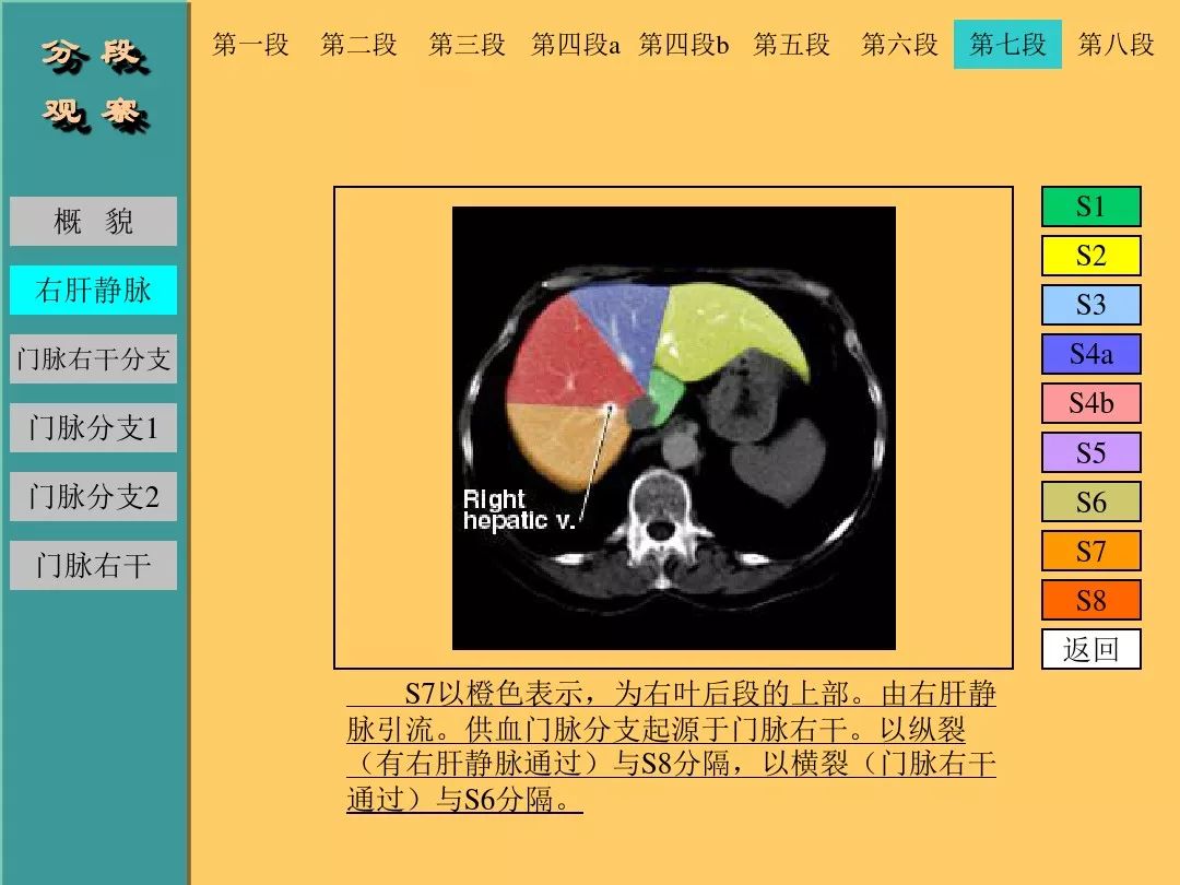 肝脏CT断层解剖详解