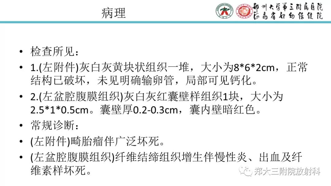 【病例】卵巢未成熟畸胎瘤1例MR影像 【病例】卵巢未成熟畸胎瘤1例MR影像
