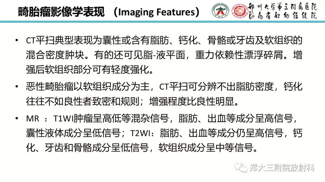 【病例】卵巢未成熟畸胎瘤1例MR影像 【病例】卵巢未成熟畸胎瘤1例MR影像