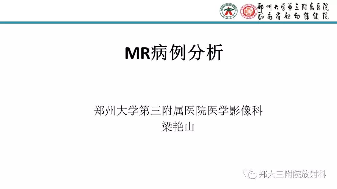 【病例】卵巢未成熟畸胎瘤1例MR影像
