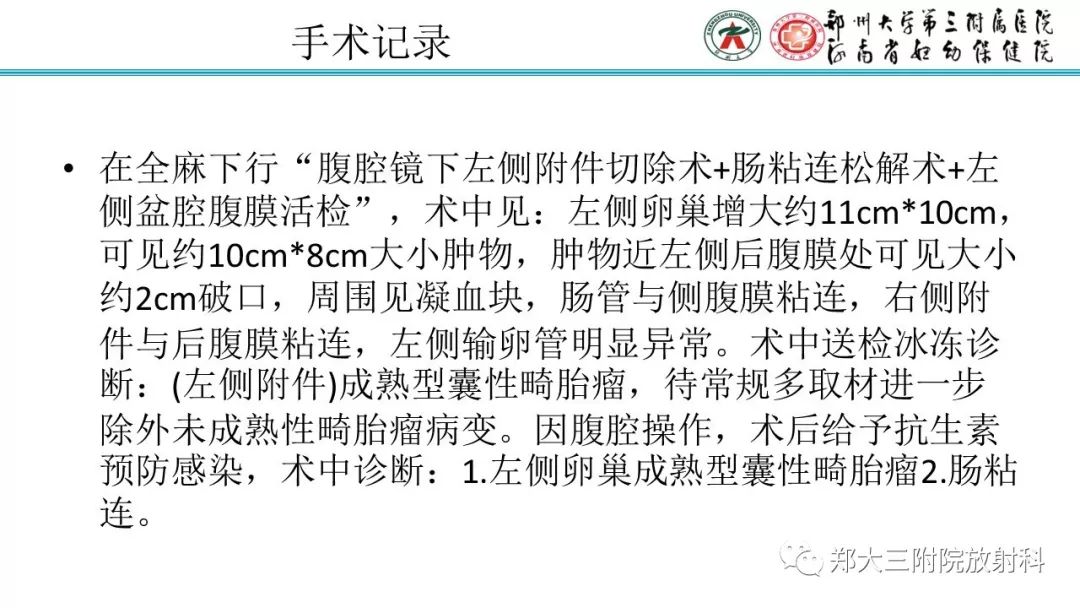 【病例】卵巢未成熟畸胎瘤1例MR影像 【病例】卵巢未成熟畸胎瘤1例MR影像