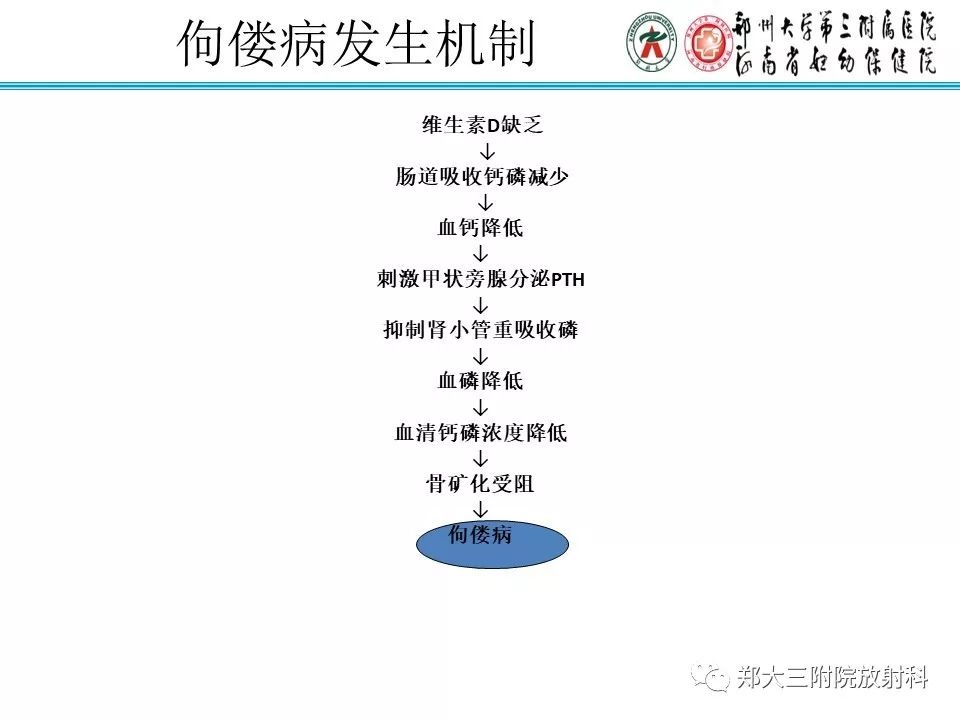 【PPT】佝偻病的影像特点 【PPT】佝偻病的影像特点