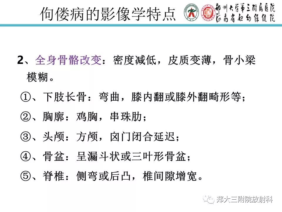 【PPT】佝偻病的影像特点 【PPT】佝偻病的影像特点