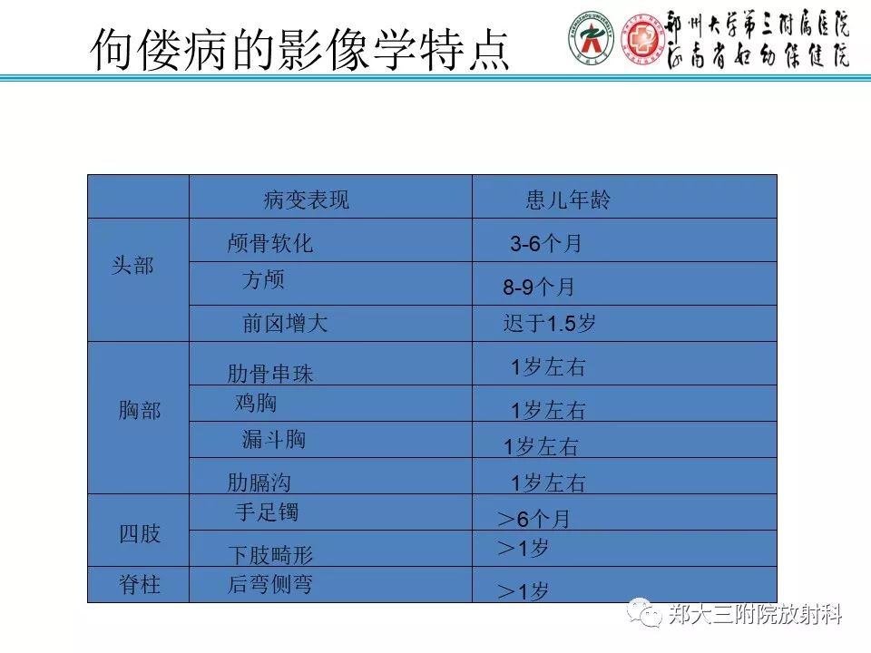 【PPT】佝偻病的影像特点 【PPT】佝偻病的影像特点