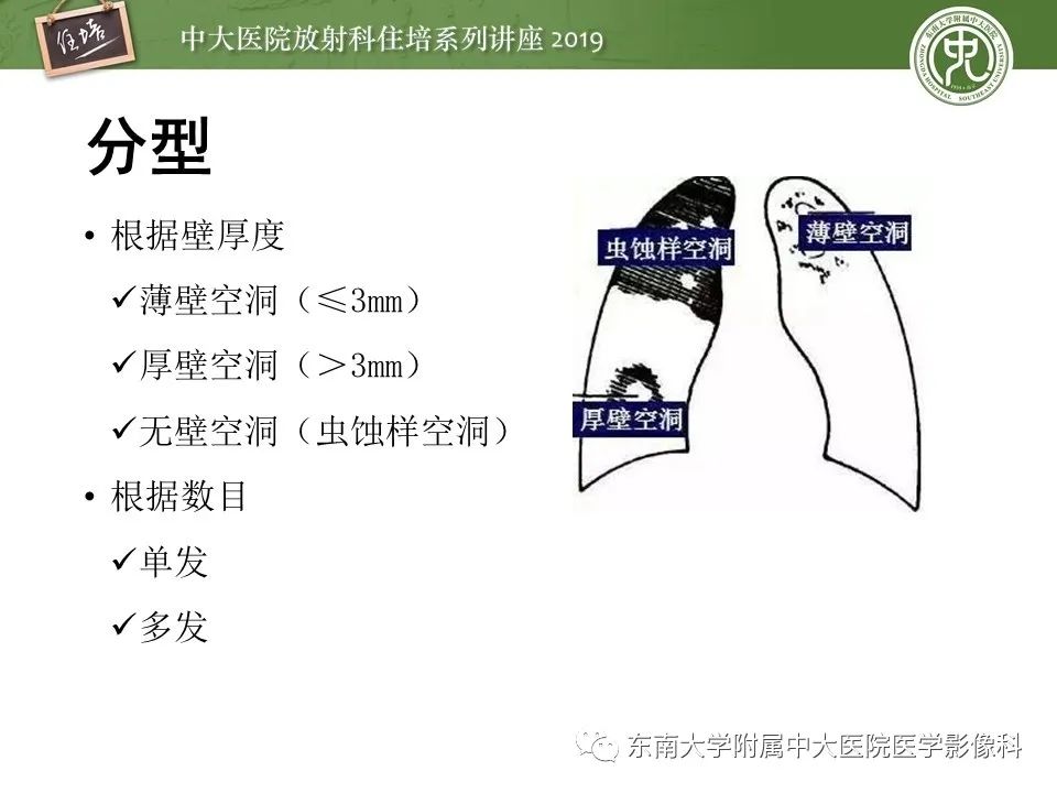 【PPT】肺空洞病变影像诊断及鉴别