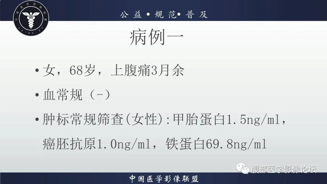 【病例】淋巴瘤与胃癌各1例CT影像