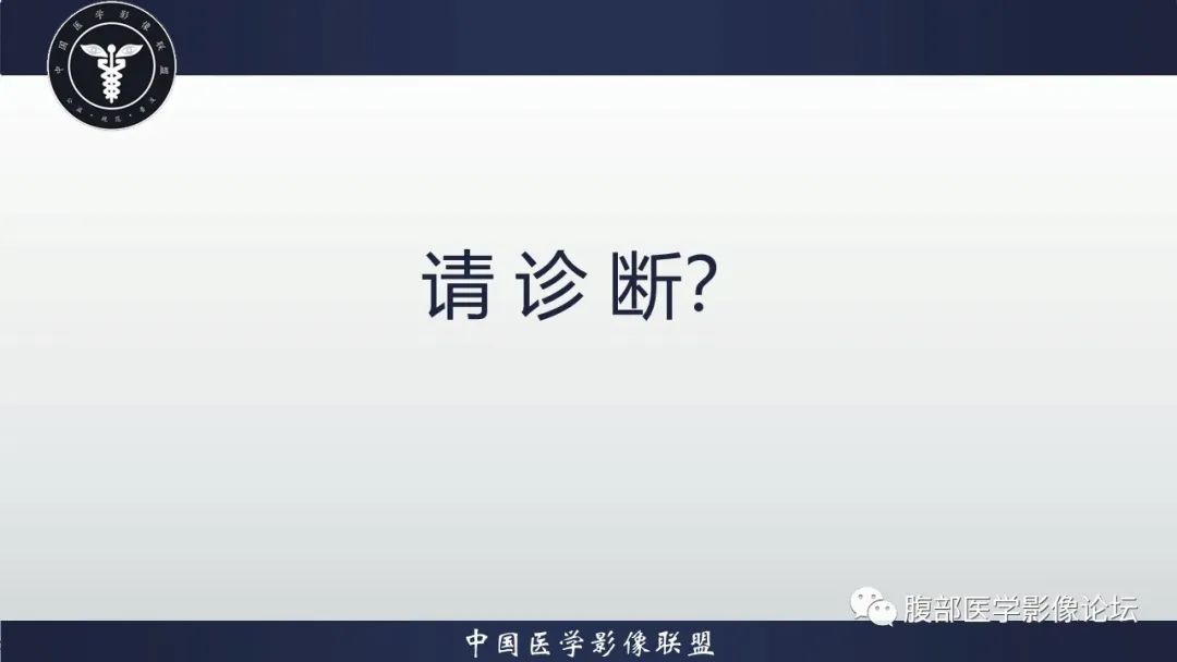 【病例】淋巴瘤与胃癌各1例CT影像
