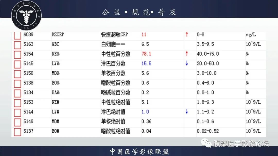 【病例】淋巴瘤与胃癌各1例CT影像