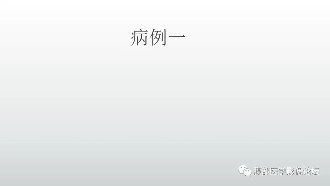 【病例】淋巴瘤与胃癌各1例CT影像