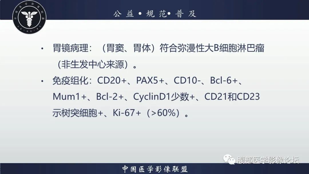 【病例】淋巴瘤与胃癌各1例CT影像