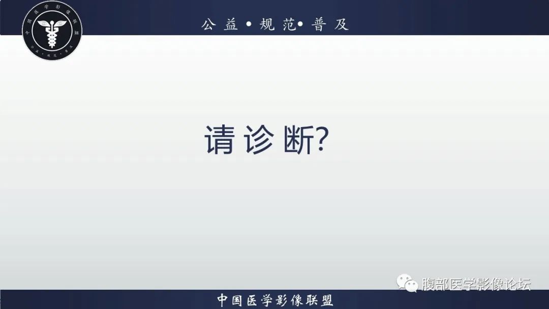 【病例】淋巴瘤与胃癌各1例CT影像