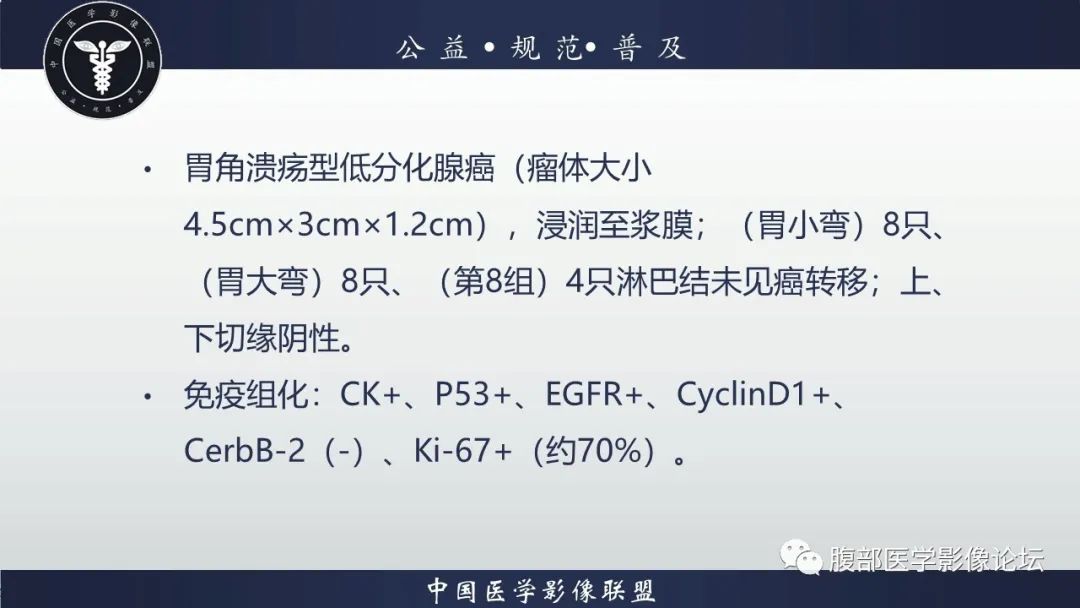【病例】淋巴瘤与胃癌各1例CT影像