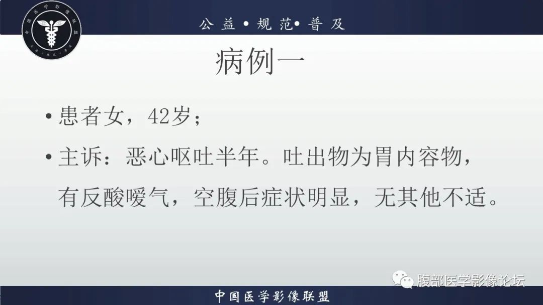 【病例】淋巴瘤与胃癌各1例CT影像