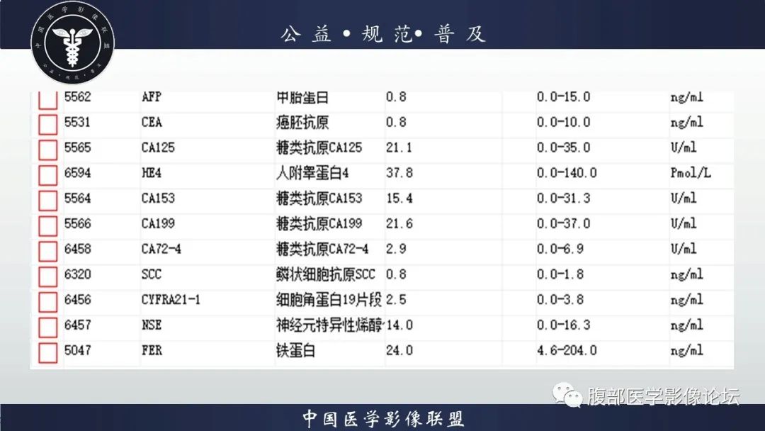 【病例】淋巴瘤与胃癌各1例CT影像