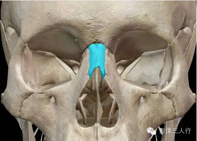 鼻骨解剖及鼻骨骨折