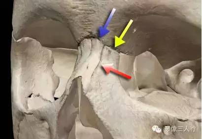鼻骨解剖及鼻骨骨折