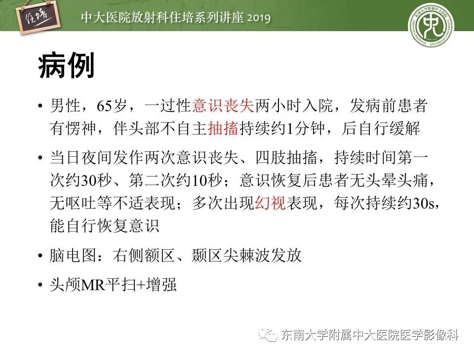 【PPT】自身免疫性脑炎影像表现及诊断