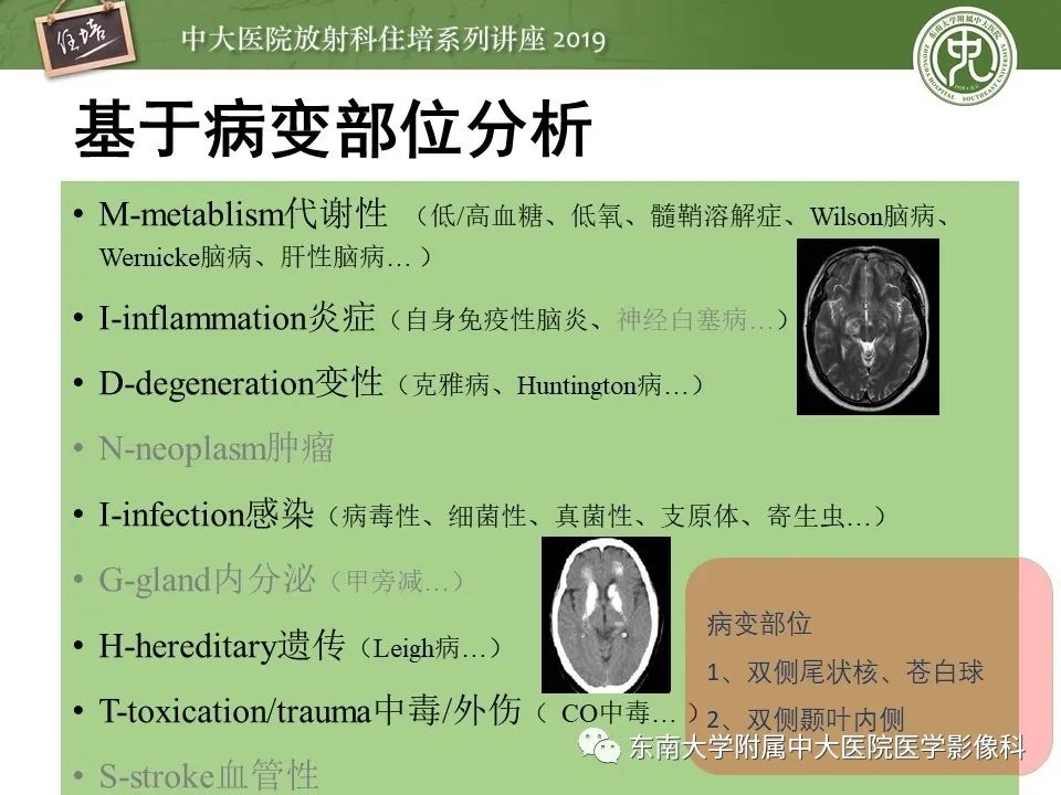 【PPT】自身免疫性脑炎影像表现及诊断