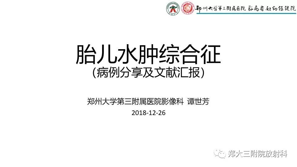 【PPT】胎儿水肿综合征
