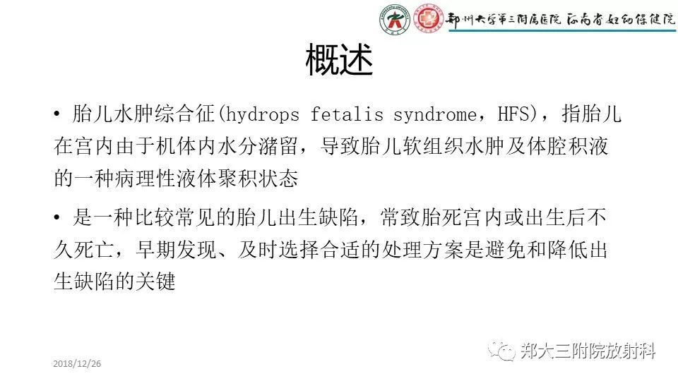 【PPT】胎儿水肿综合征