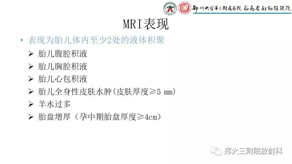 【PPT】胎儿水肿综合征